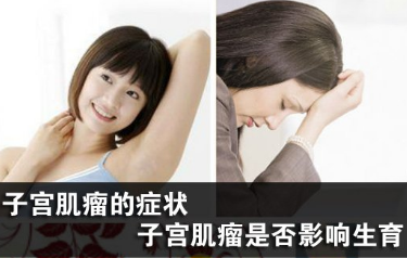 运城子宫肌瘤会影响怀孕吗