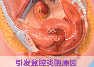 运城盆腔炎的原因有哪些