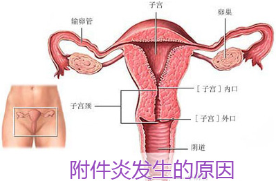 运城附件炎有哪些危害